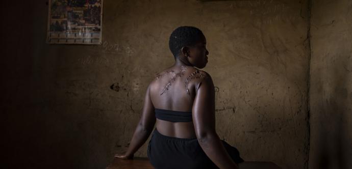 Femme présentant des traces de violences physiques