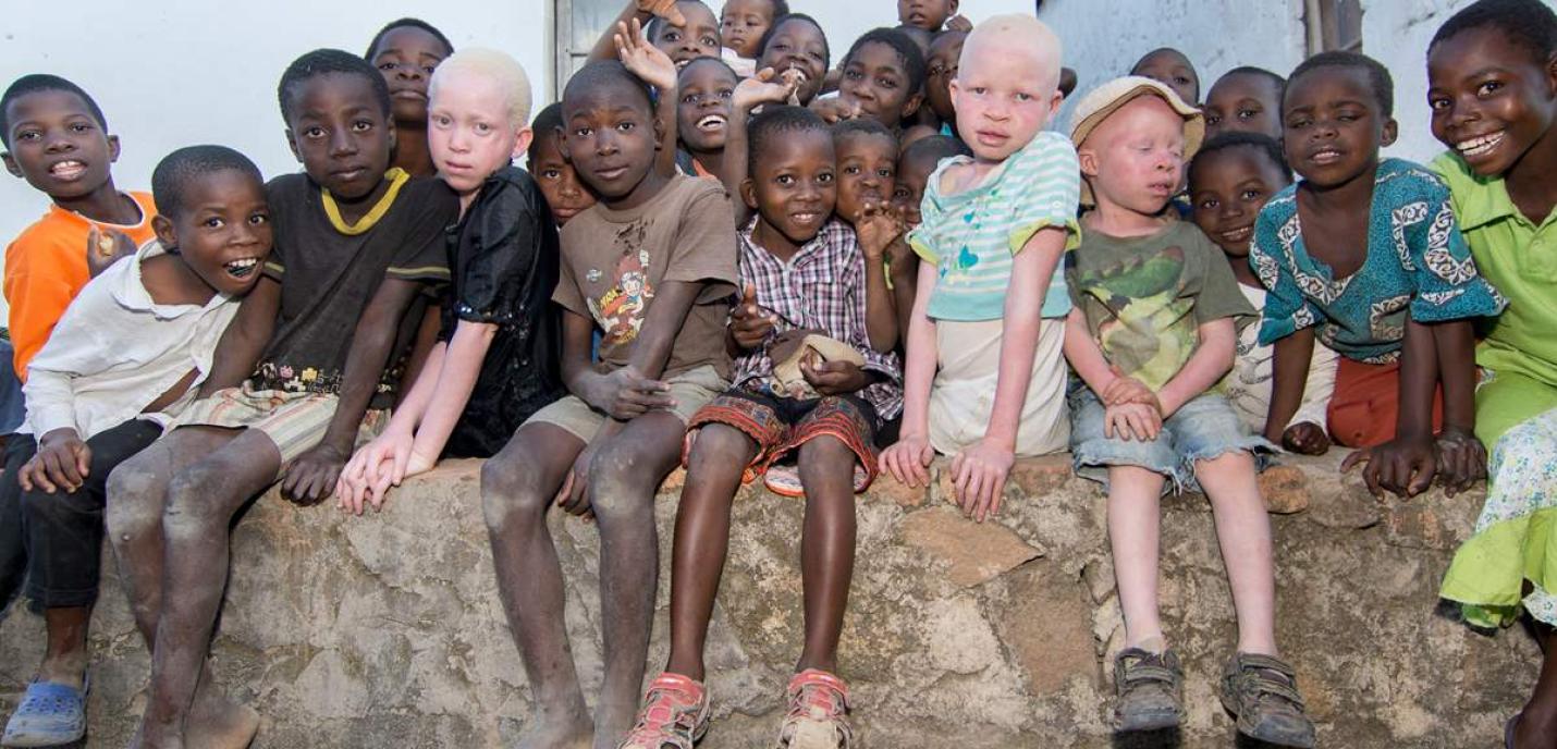 Discrimination contre les personnes albinos